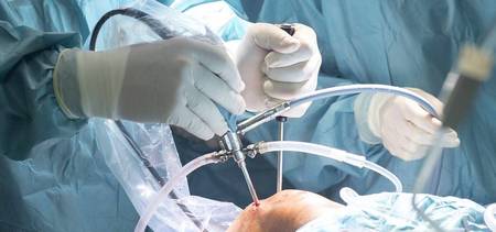 Cirugía Artroscópica